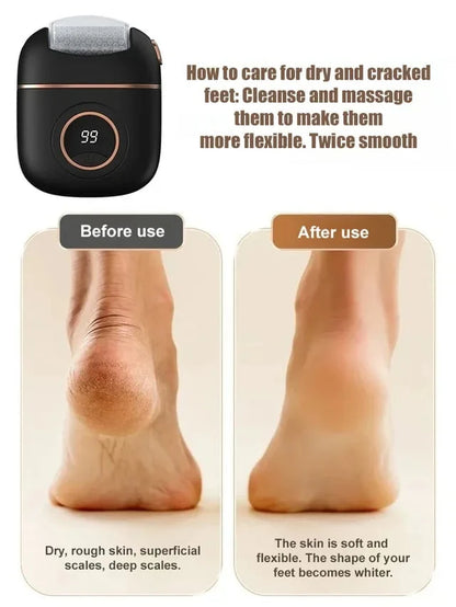 2025 New digital electric foot polishing machine